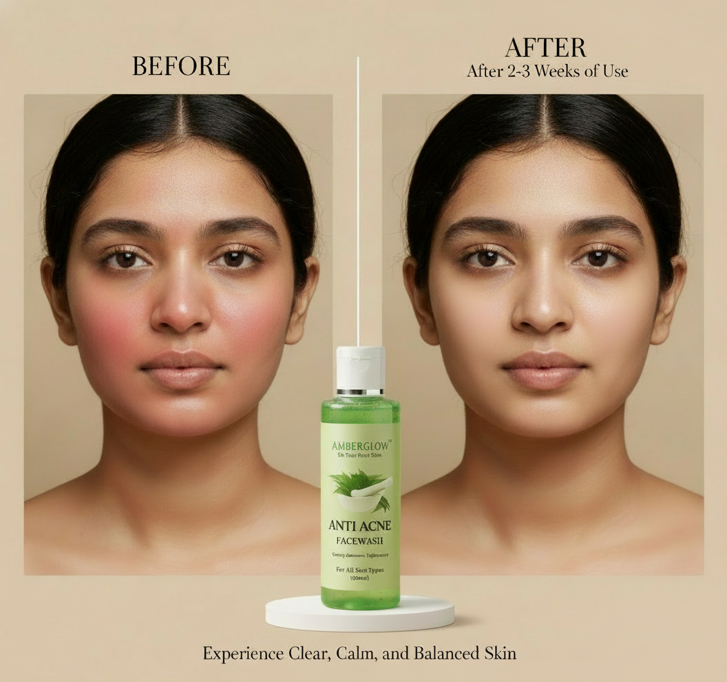 Anti Acne Face Wash